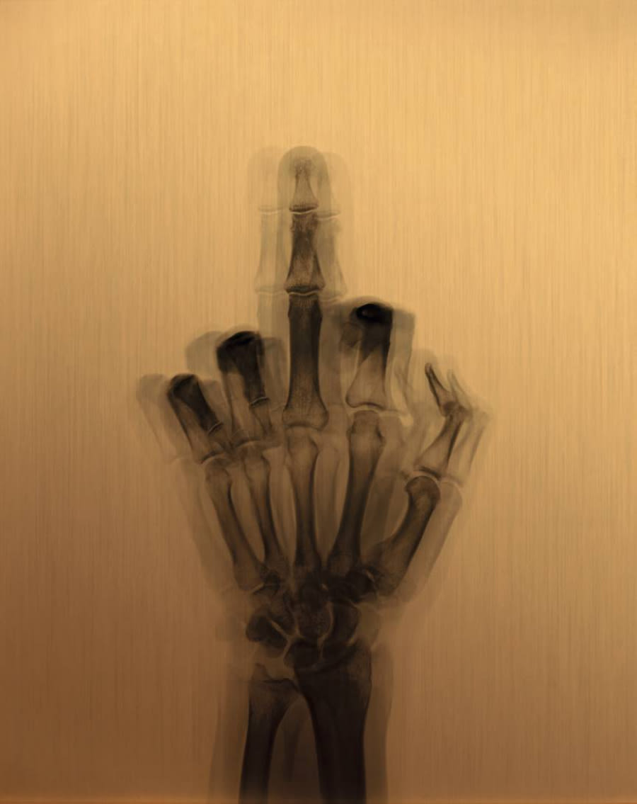 Nick Veasey, Goldfinger, 2021
