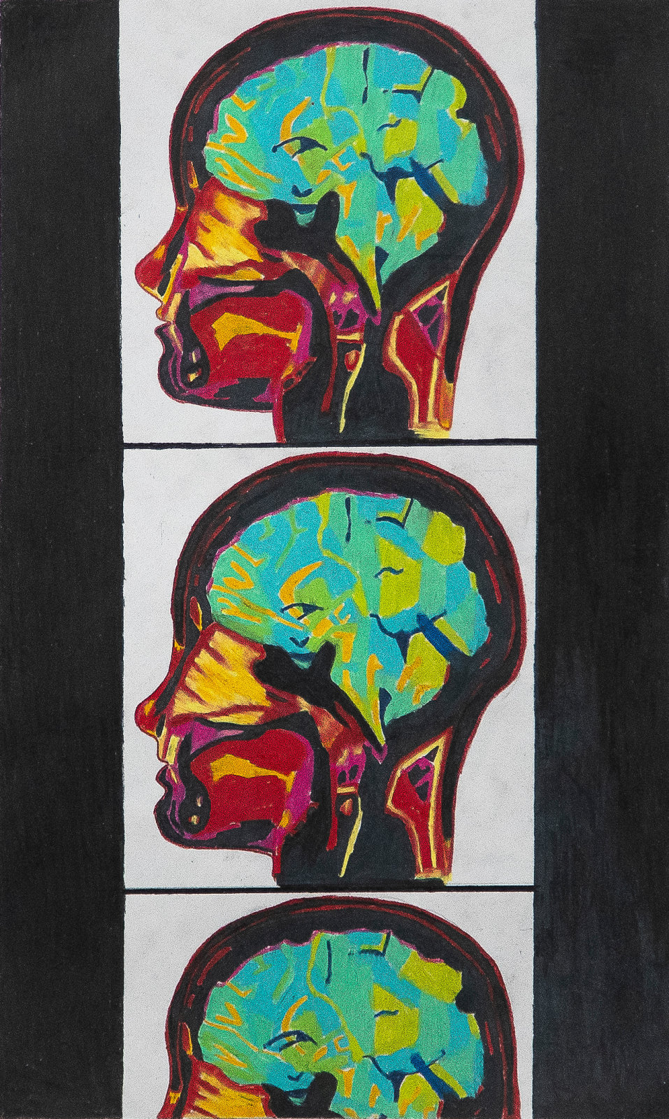 Valeria Moel Slutzky, "Brainscan"