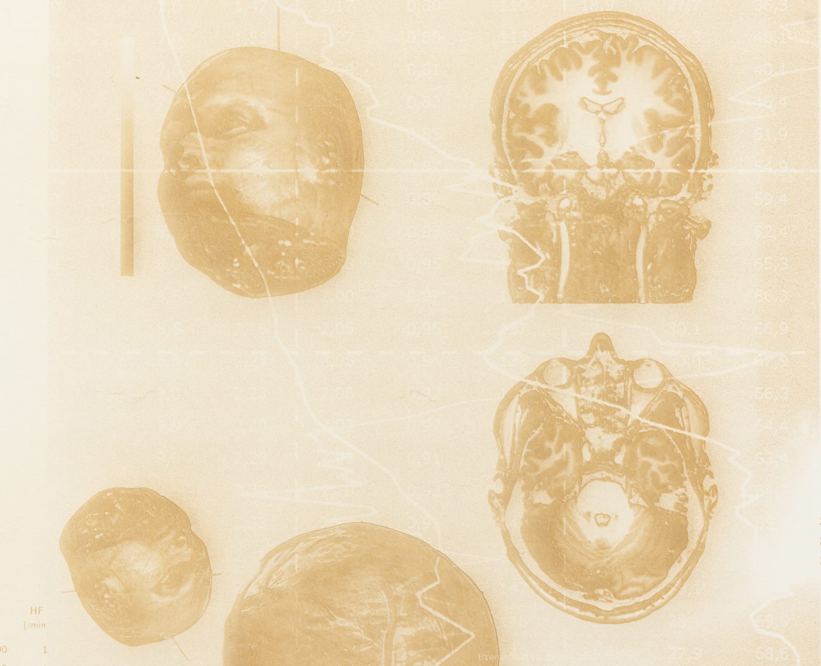 Justin Urbach, FreezeFrame I, 2024