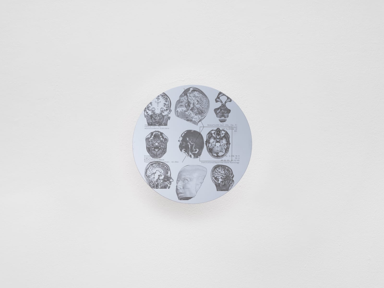 Justin Urbach, Fractal Breeze WIP T1_005, 2023