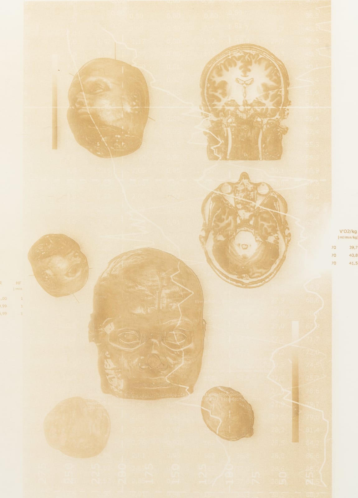 Justin Urbach, FreezeFrame I, 2024