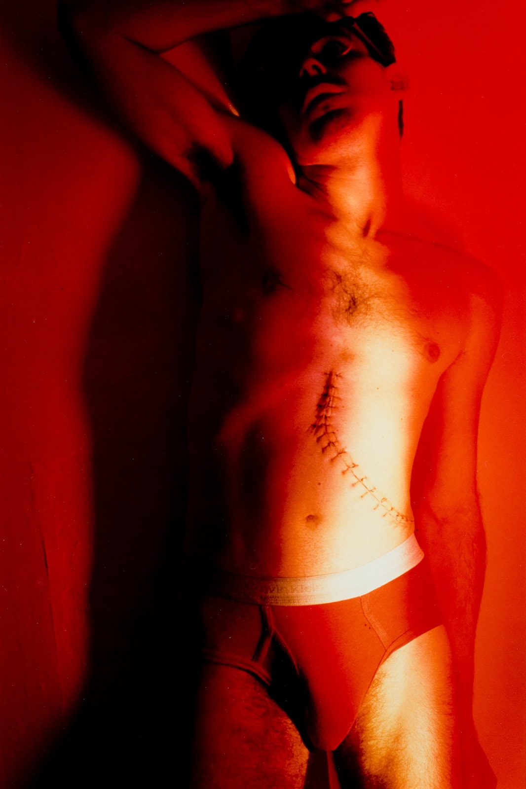 Jimmy DeSana, Stitches, 1984
