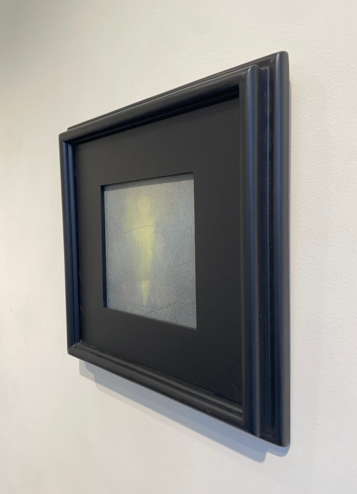 John Paul Vincent, X Ray of an Unborn Soul