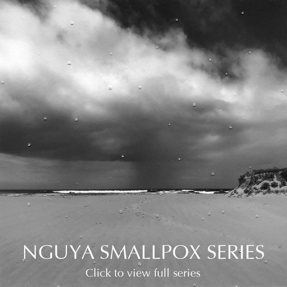 James Tylor, Nguya Smallpox series, 2020