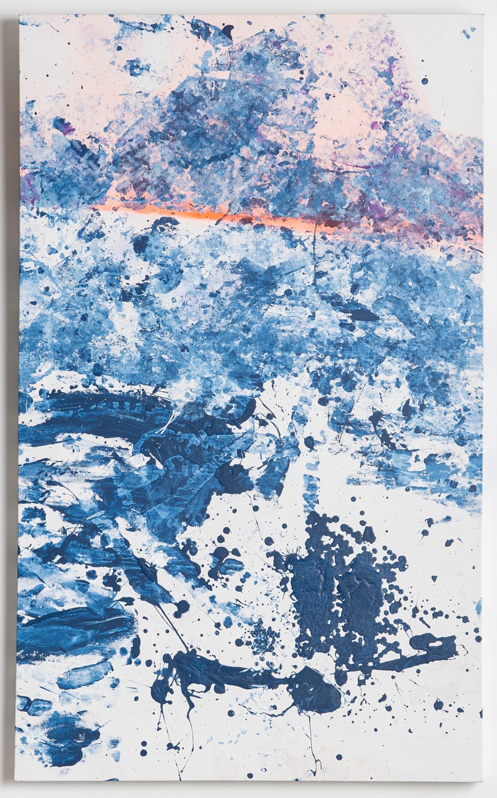 Paul Fentress, RFA (Radiofrequency Ablation), 2025