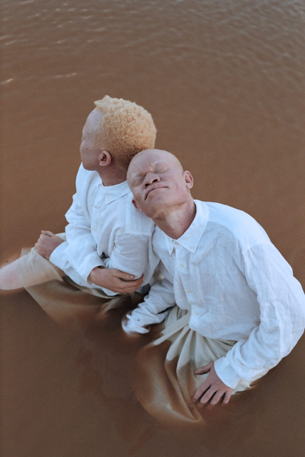 Denisse Ariana Pérez, Albinism I , 2019