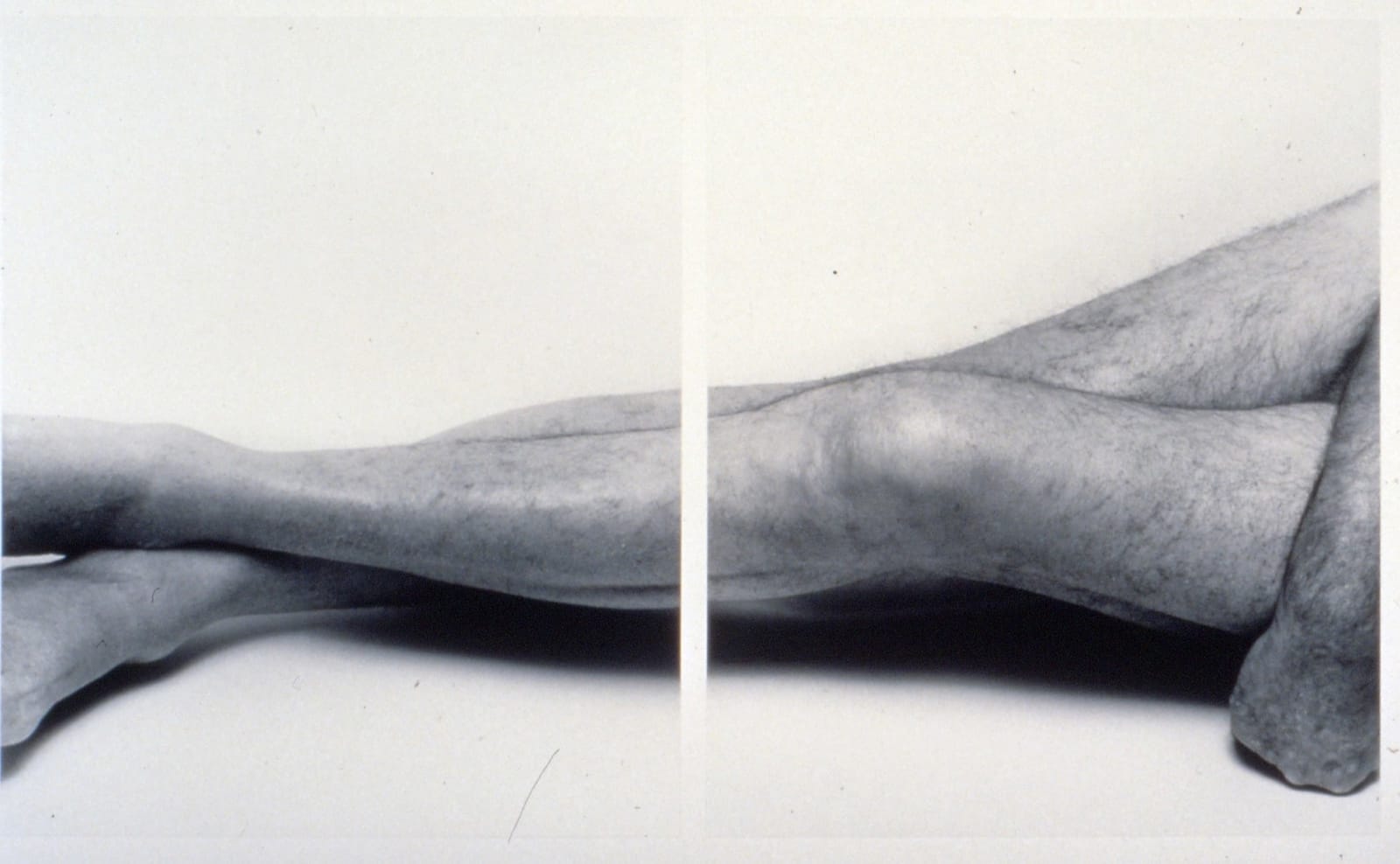 John Coplans, Legs Horizontal, No. 7, 1998