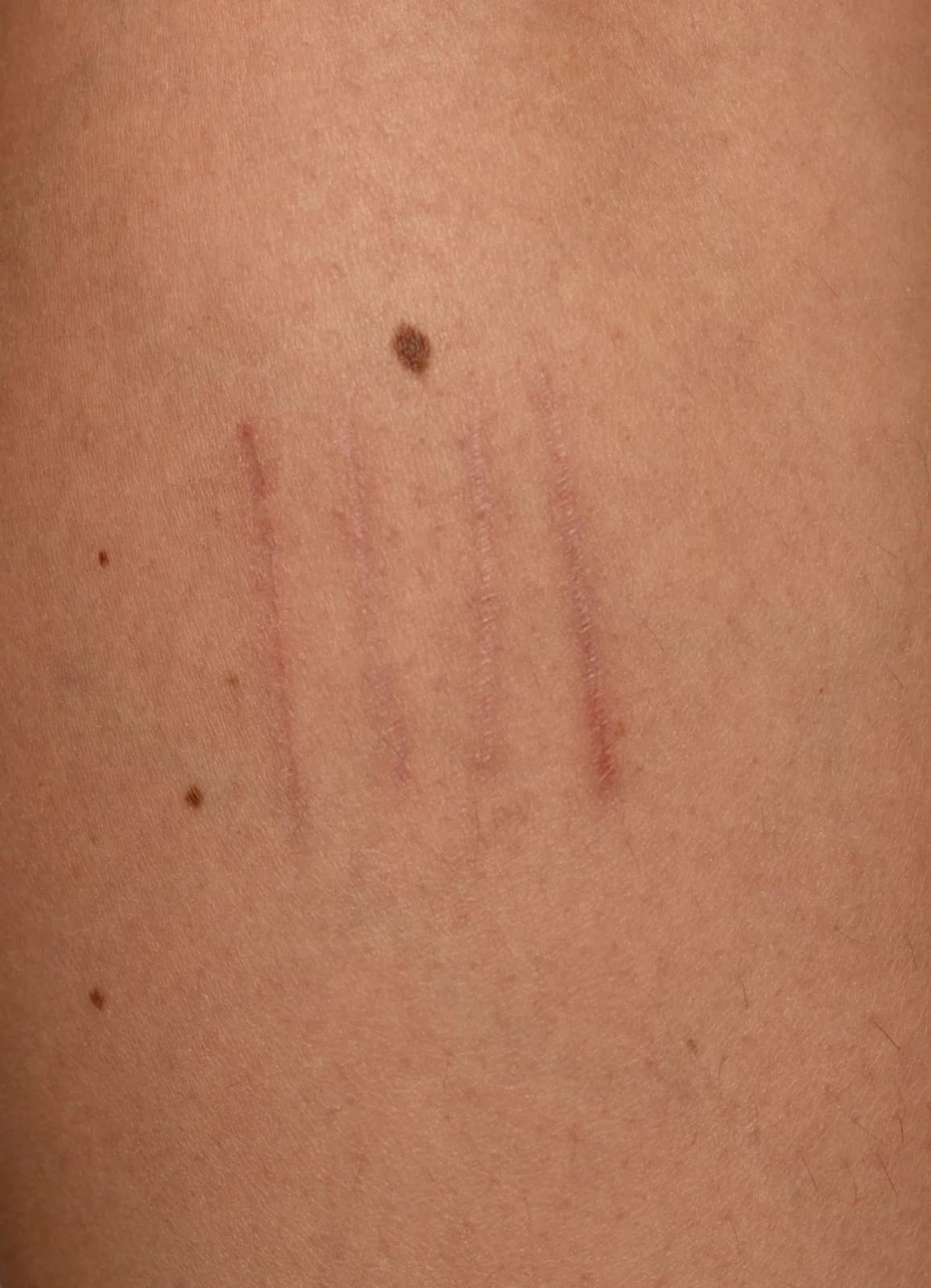 Nicole Wilson, Ötzi: Tattoo Design T_02, 2021