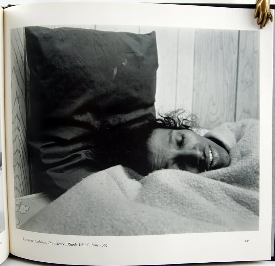 People with AIDS. Photograph