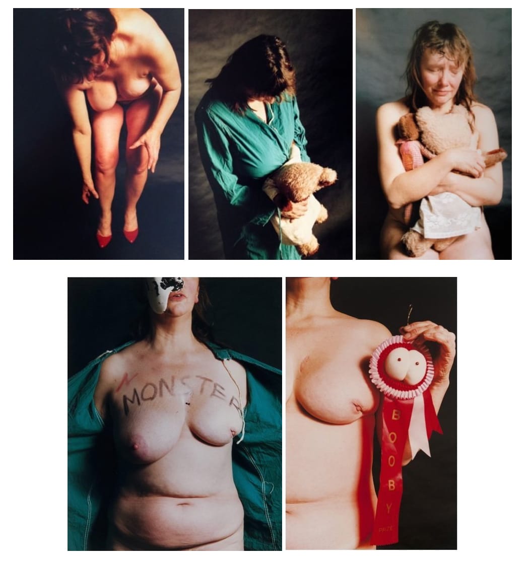 Jo SPENCE, Narratives of Dis-ease, 1990
