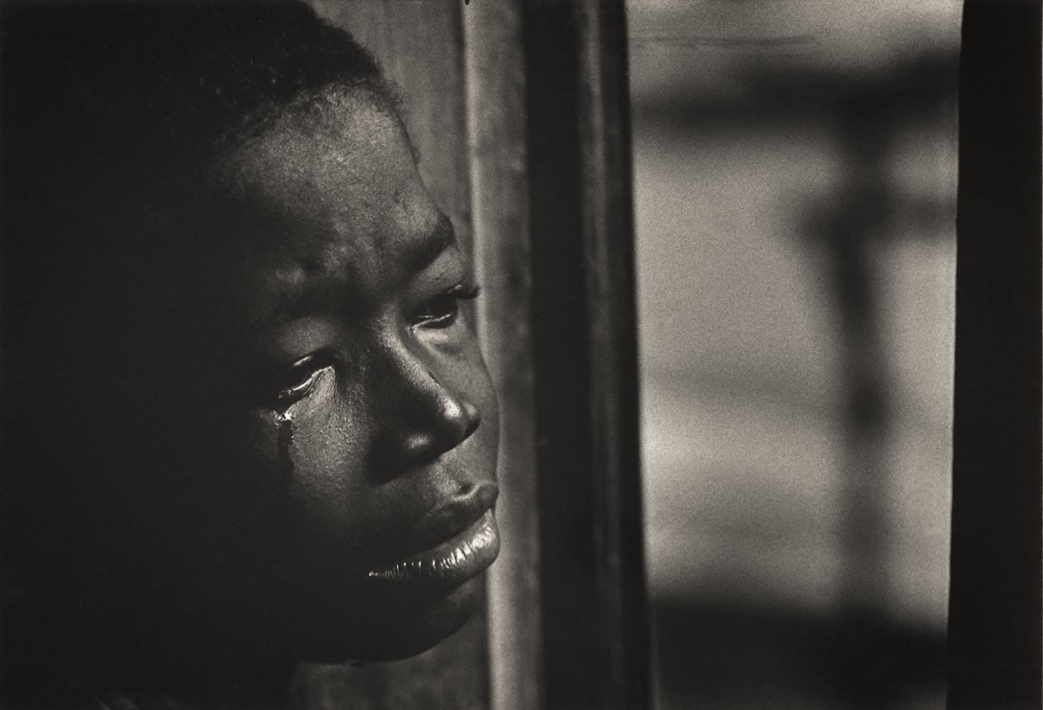 W. Eugene Smith, Sad Boy from the Albert Schweitzer story; "A Man of Mercy" for Life Magazine, 1954