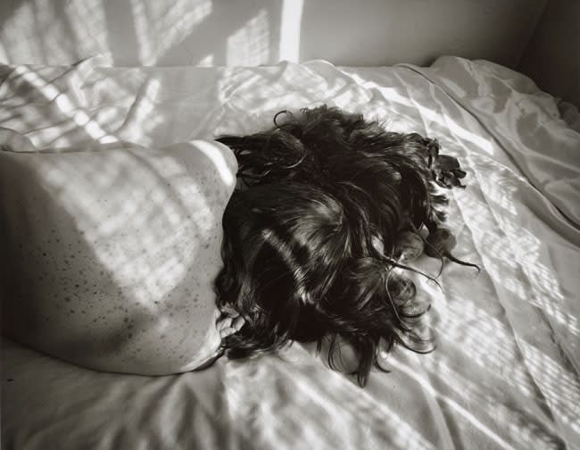 Jo Ann Callis, Untitled, [freckles and beets] from the Early Black and White Portfolio, Circa Early 1970's