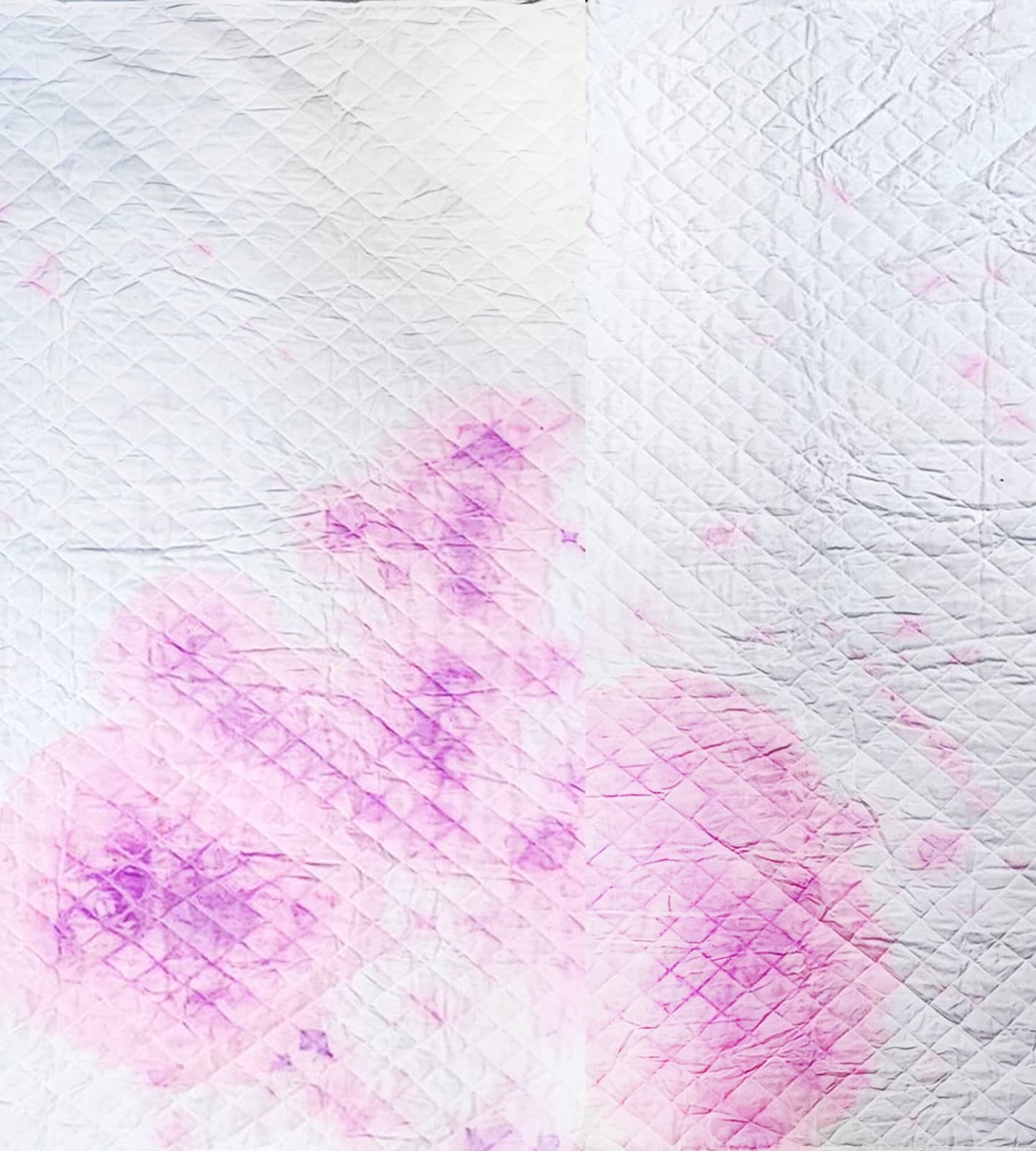 Sasapin Siriwanij, A bloody business (set B) no.11, 2022