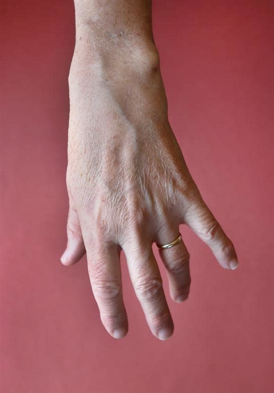 Kevin Capon, Vena Amoris, 2014