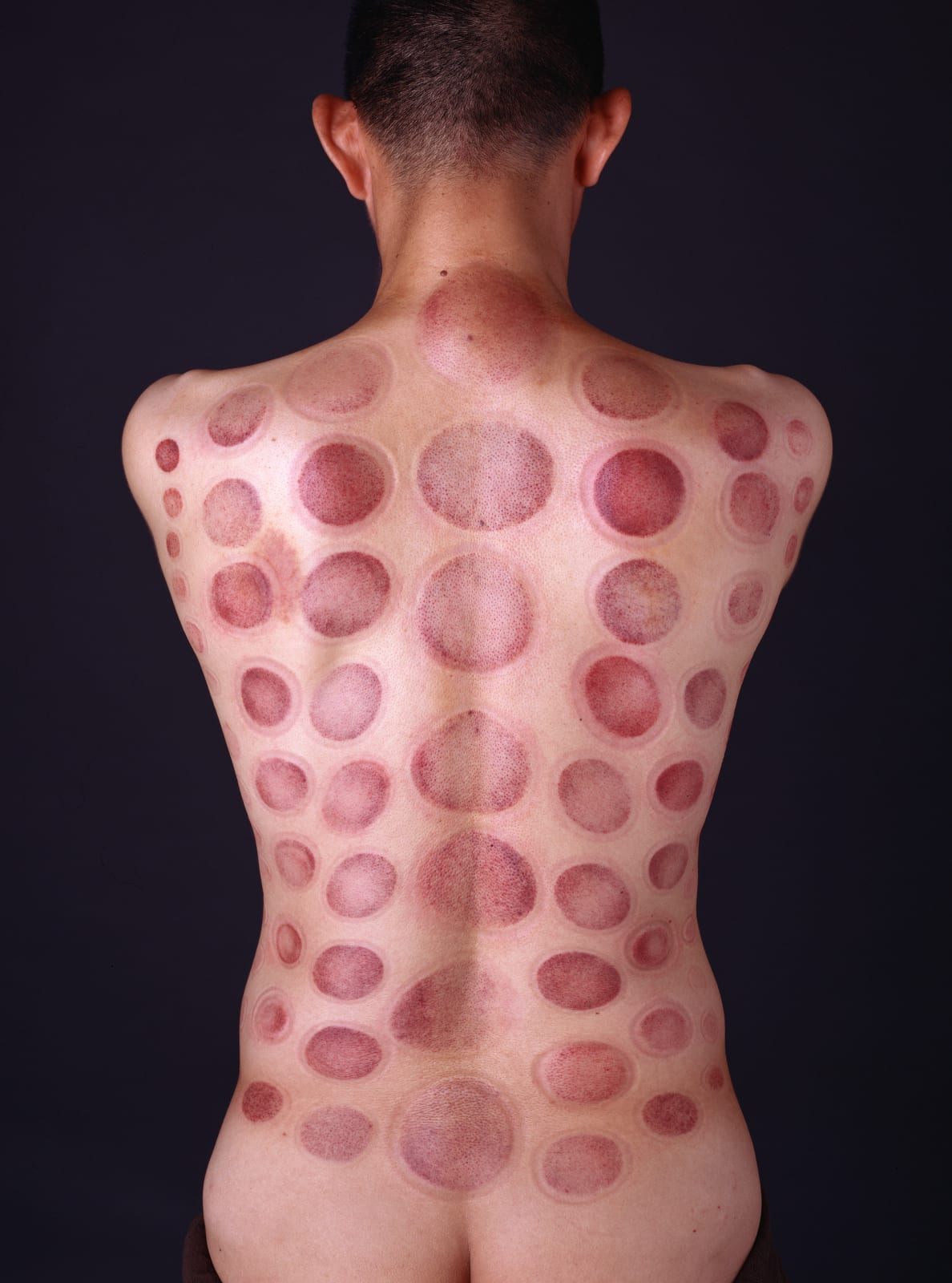 Shi Jin-Hua, Fatigue Measurement - A Tribute to Yayoi Kusama, 2009/2019
