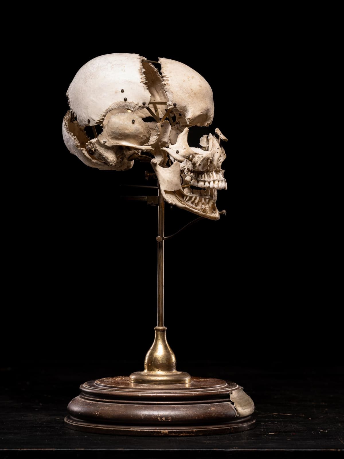 Edmé François Chauvot de Beauchêne disarticulated or exploded human skull, France, 19th Century
