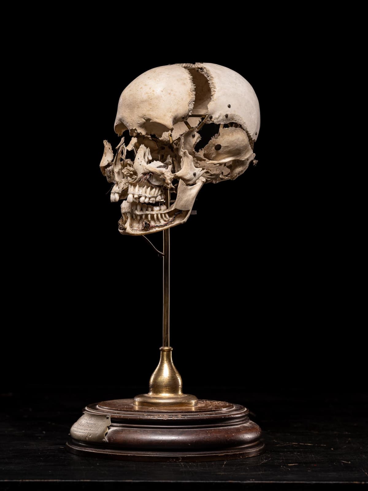 Edmé François Chauvot de Beauchêne disarticulated or exploded human skull, France, 19th Century