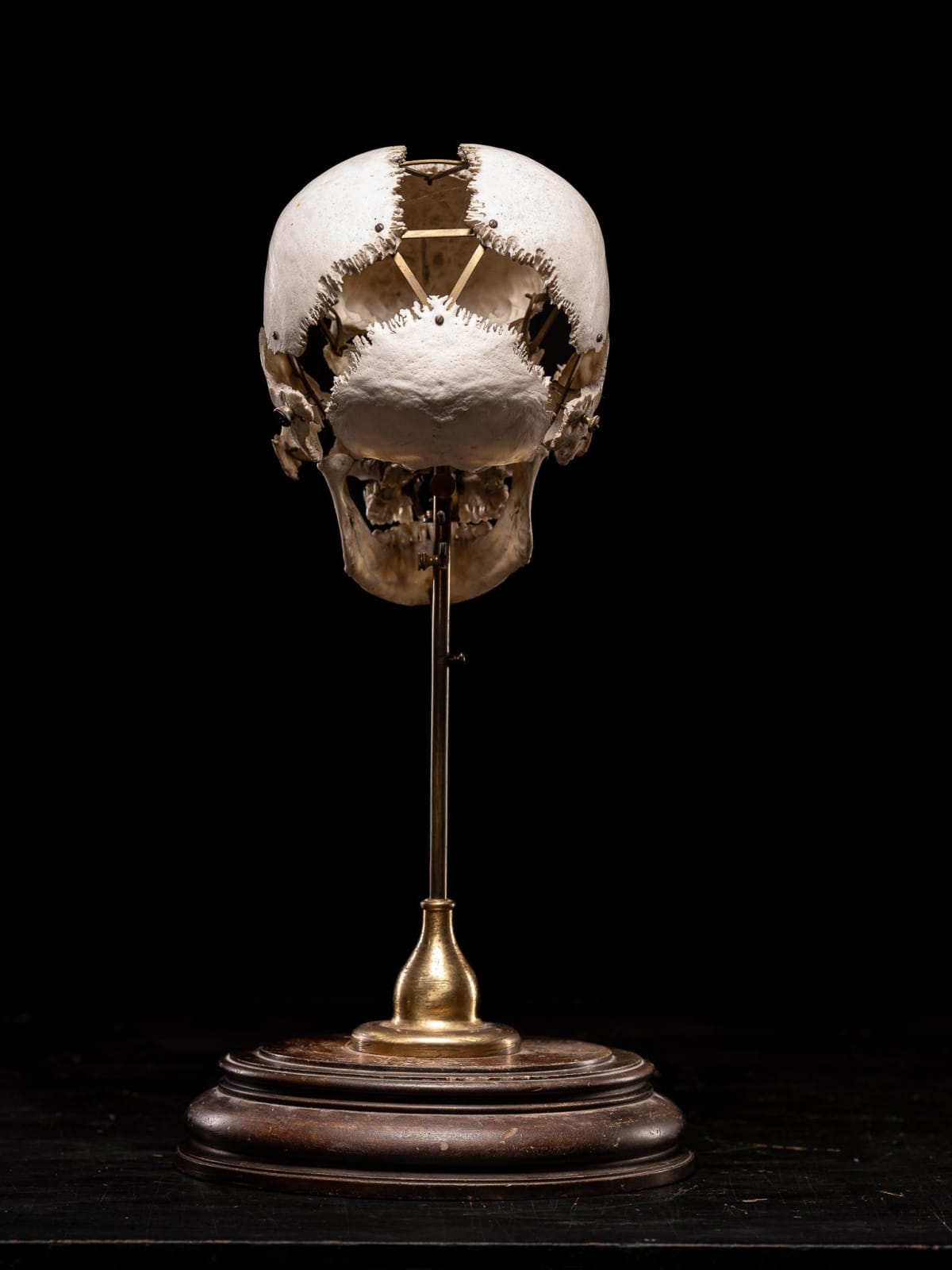Edmé François Chauvot de Beauchêne disarticulated or exploded human skull, France, 19th Century
