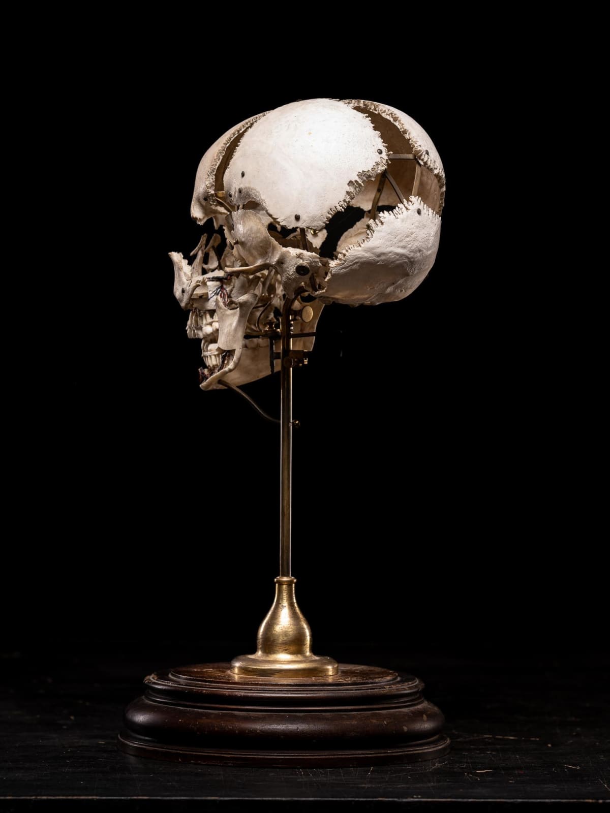 Edmé François Chauvot de Beauchêne disarticulated or exploded human skull, France, 19th Century