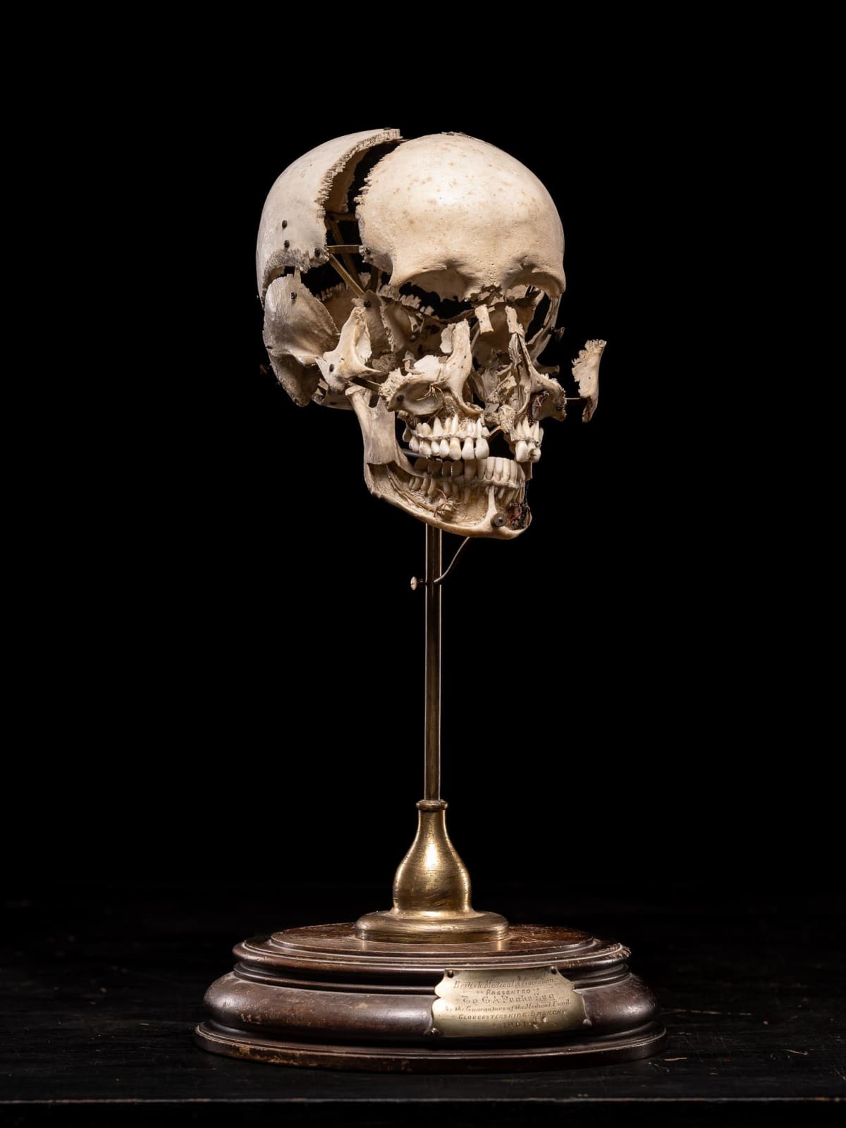 Edmé François Chauvot de Beauchêne disarticulated or exploded human skull, France, 19th Century