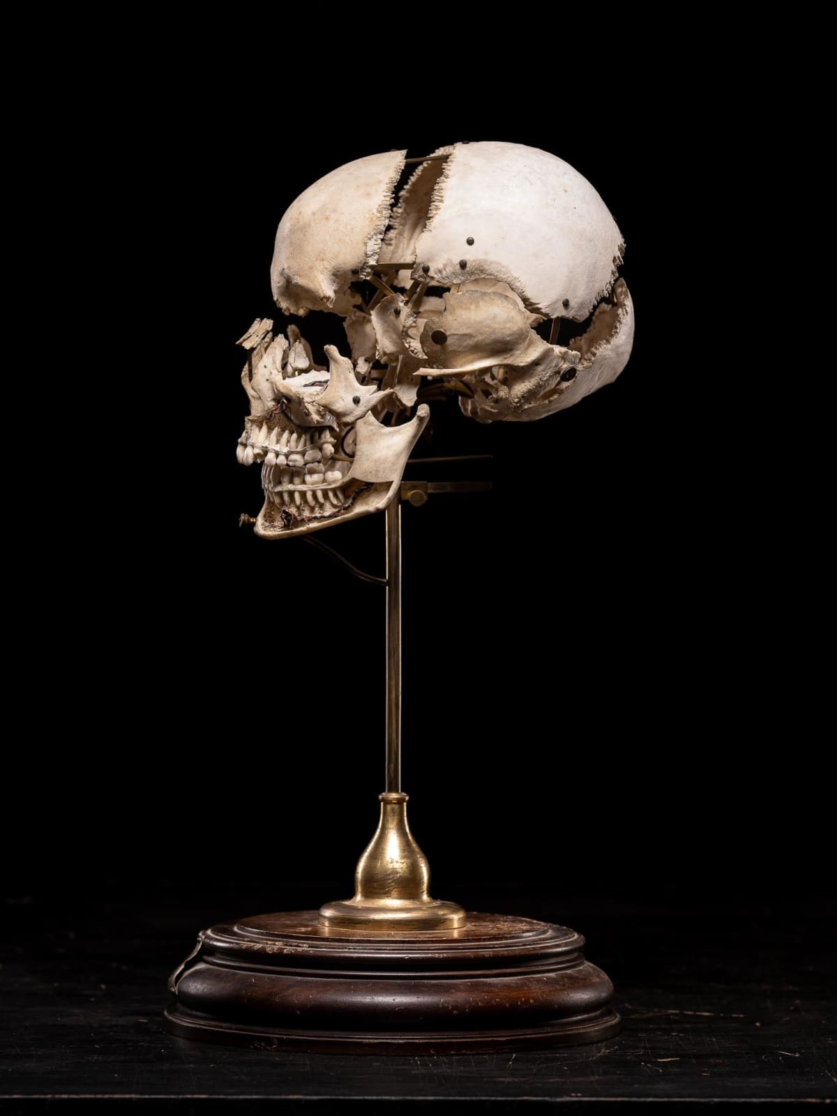 Edmé François Chauvot de Beauchêne disarticulated or exploded human skull, France, 19th Century