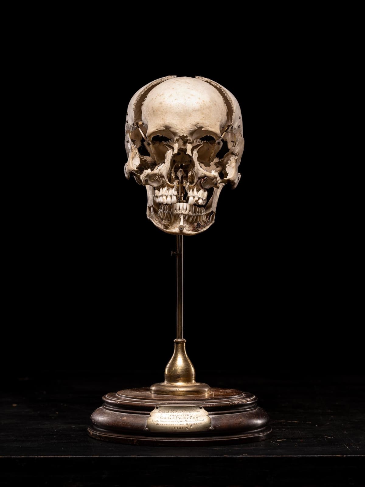 Edmé François Chauvot de Beauchêne disarticulated or exploded human skull, France, 19th Century