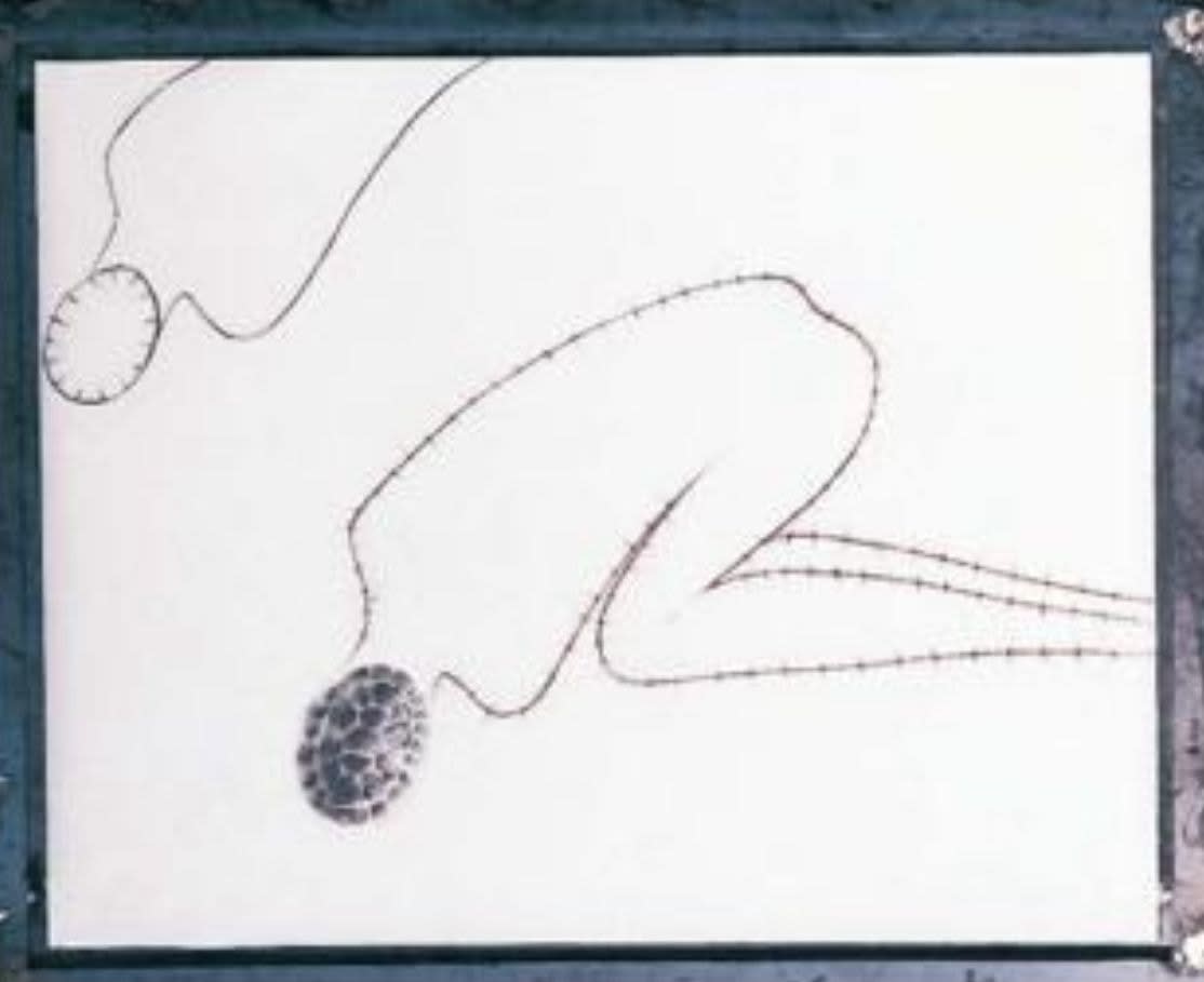 Pepe Espaliú, Untitled