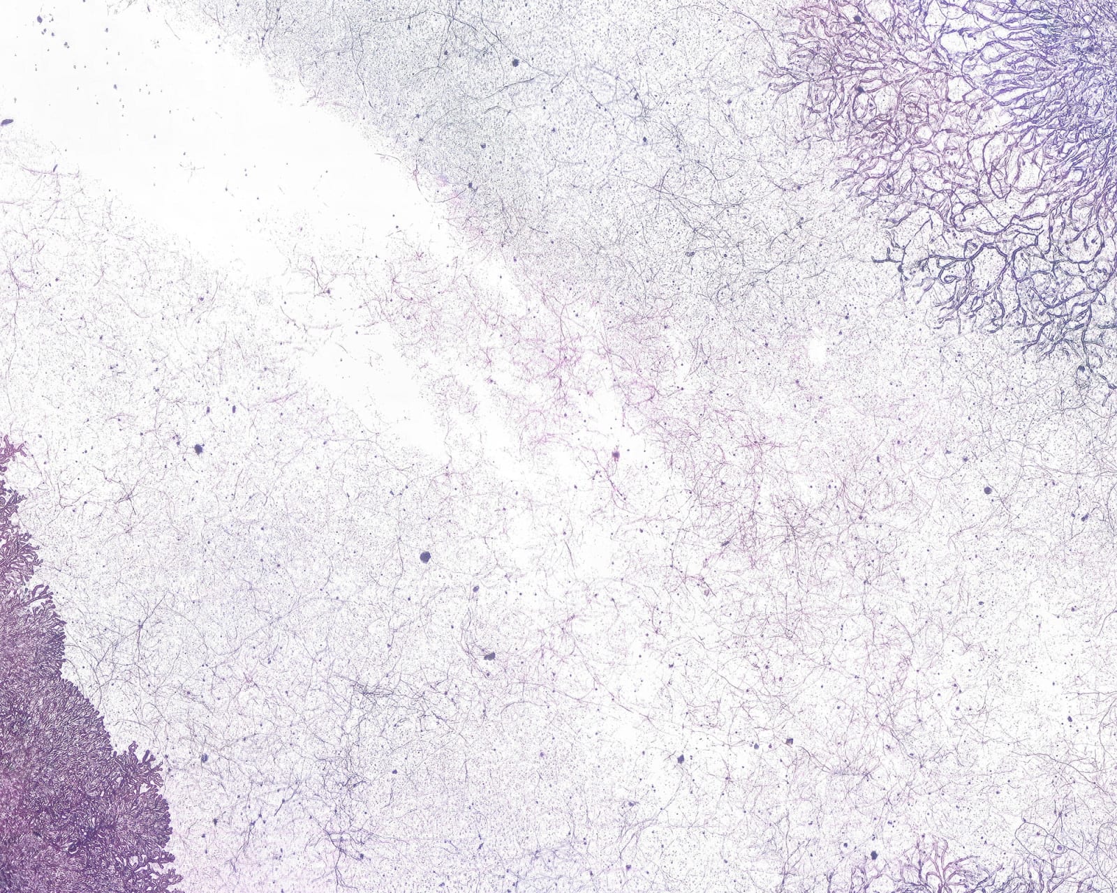 Wei Leng Tay, One full frame 135mm colour reversal film slide. “National Parks Board Of W.A.” and “18 The Shawl” printed on one side, and “KODACHROME DUPLICATE” and ‘“MADE BY Kodak” on the other, of a heat-sealed cardboard slide mount. In a yellow plastic slide box. // 150x magnification. Full coaxial episcopic, and transmitted illumination. Fragmented. // 10 variable sizes on archival pigment print. Photograph ten., 2022