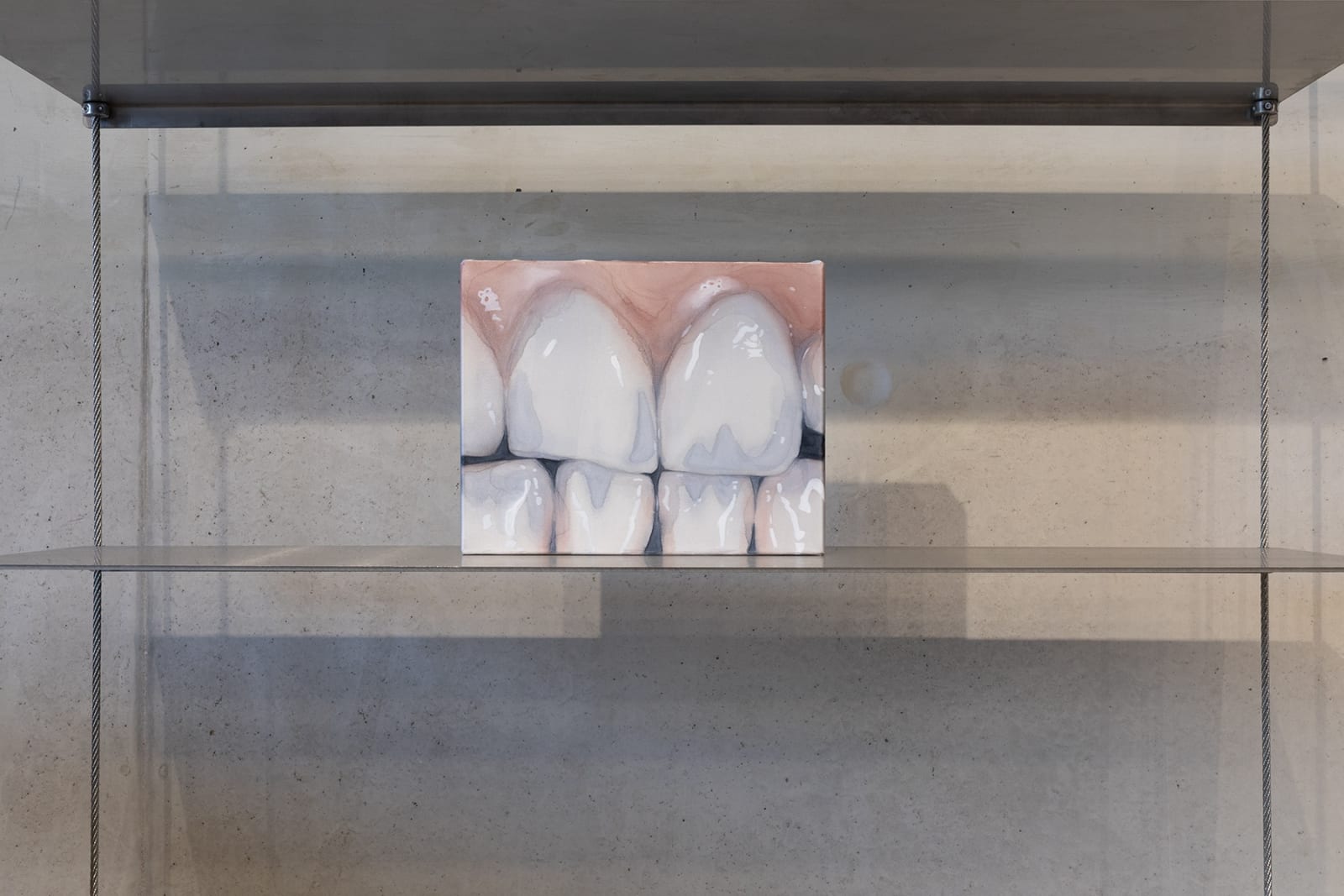 Naomi Boiko Stapleton, Behind the bite, 2023