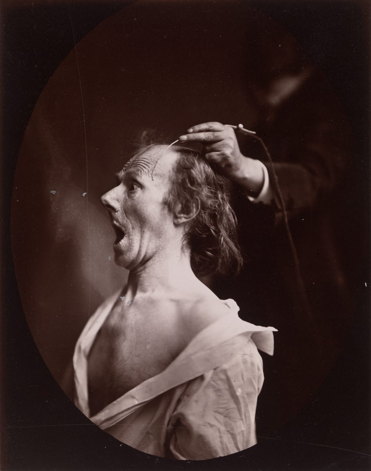 Adrien Tournachon, Study of Facial Expression