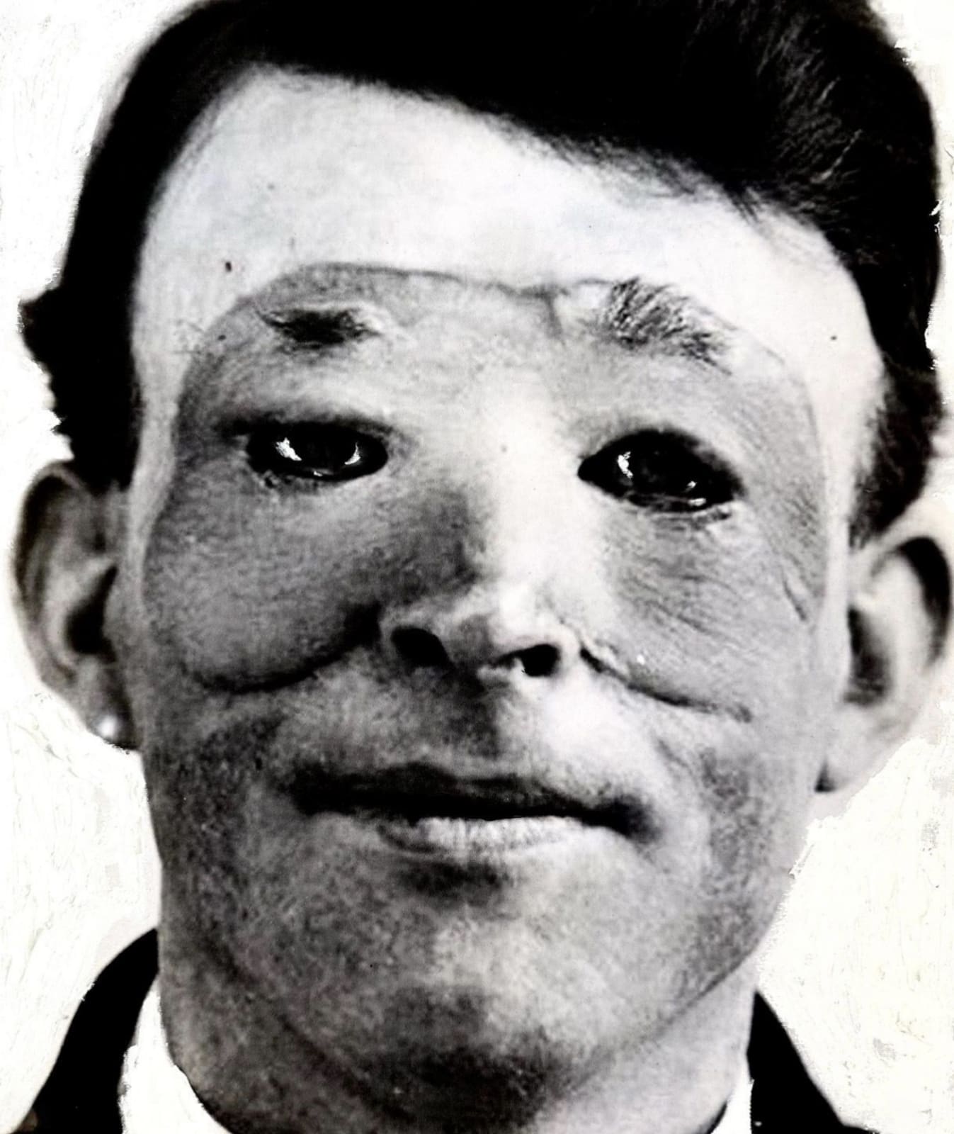 Richie Culver, Disfiguration (2), 2025