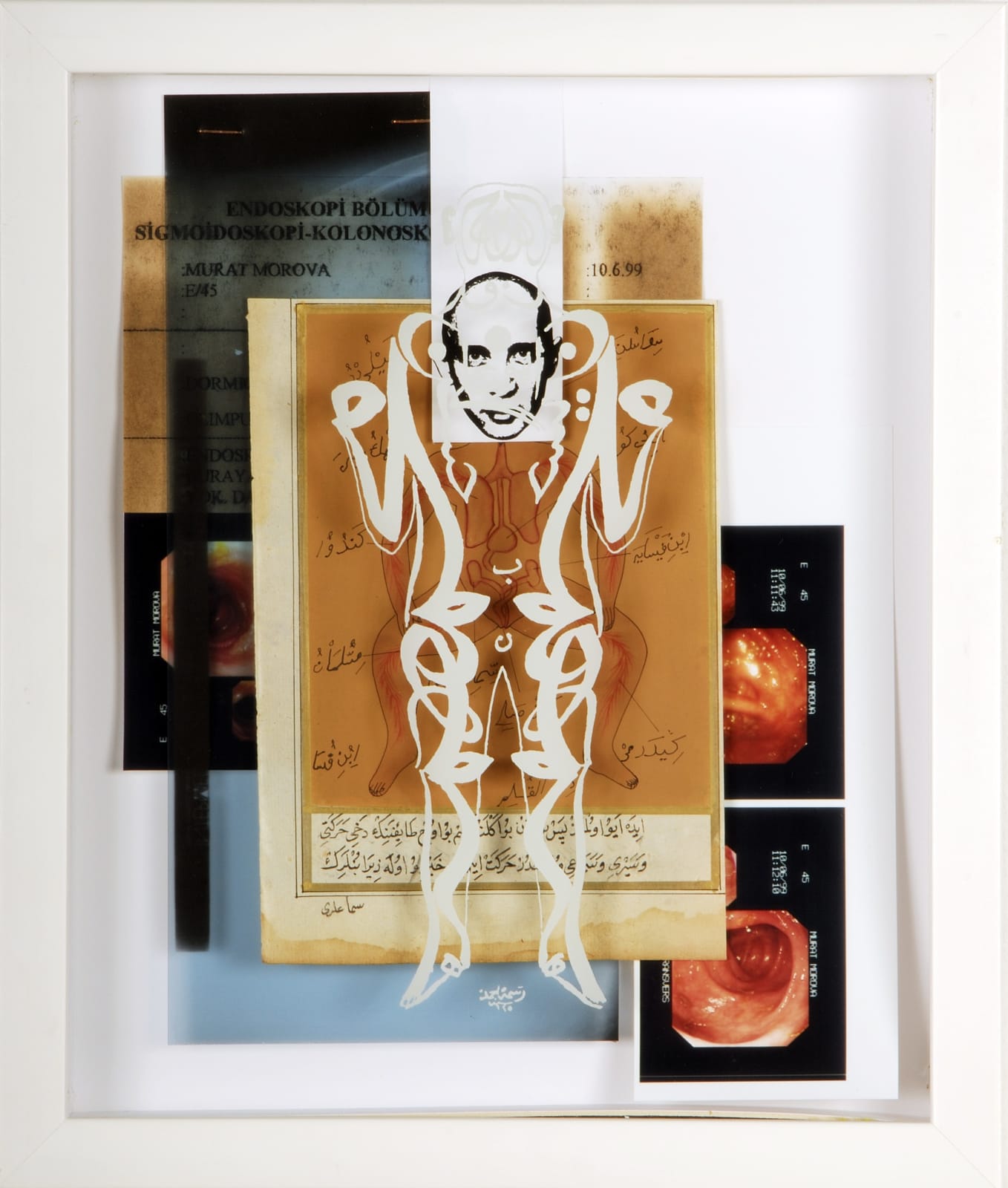 MURAT MOROVA, Ten Yorgunu – 8, 2000