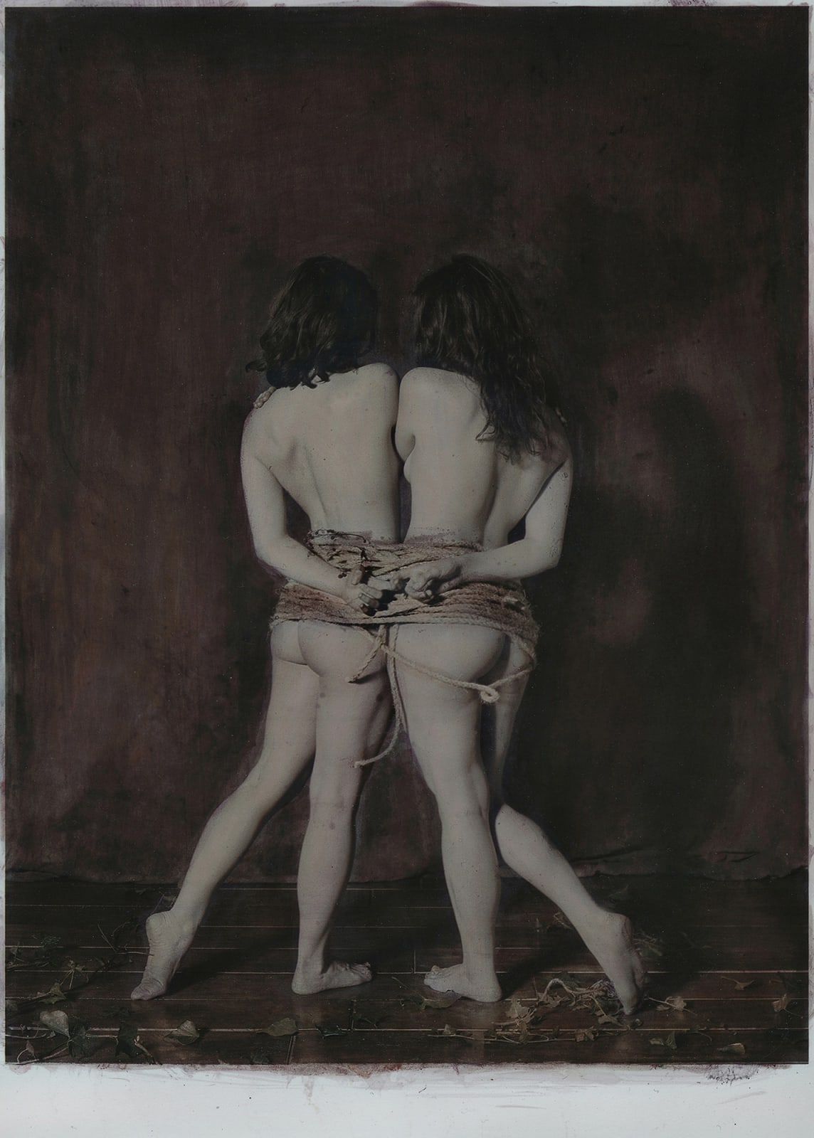 Katie Eleanor, VIII. Omphalopagus monster, an orphan, 2015