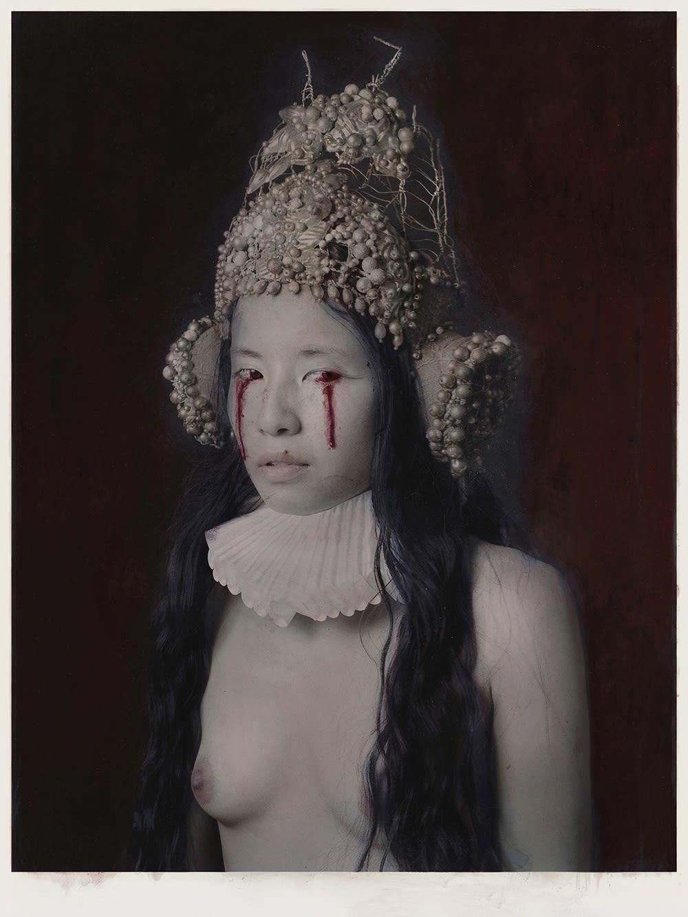Katie Eleanor, IV., Eye Infection As A Result Of Ingesting Poison, 2015, 2015