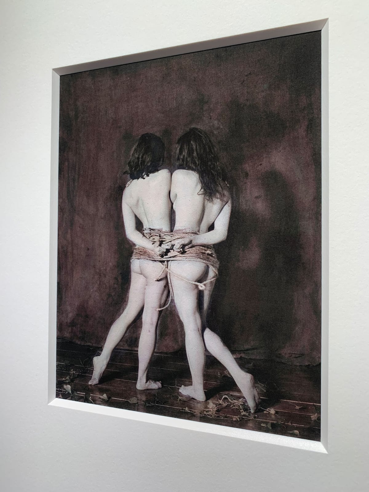 Katie Eleanor, VIII. Omphalopagus monster, an orphan, 2015