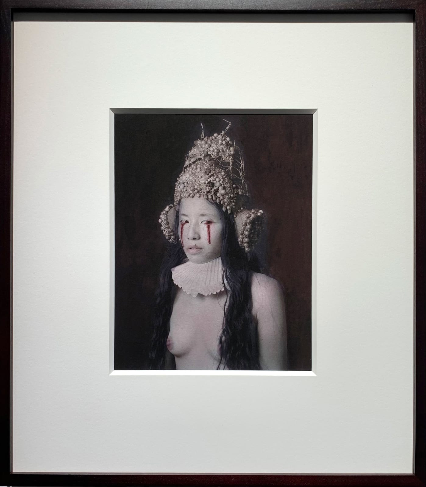 Katie Eleanor, IV., Eye Infection As A Result Of Ingesting Poison, 2015, 2015