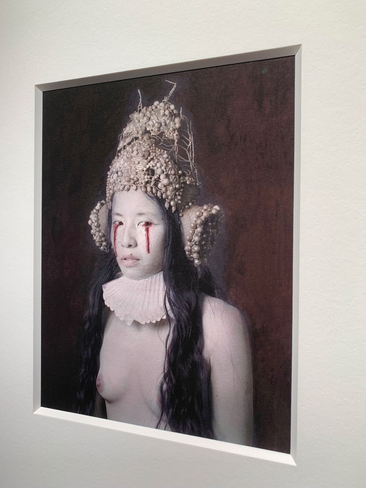 Katie Eleanor, IV., Eye Infection As A Result Of Ingesting Poison, 2015, 2015