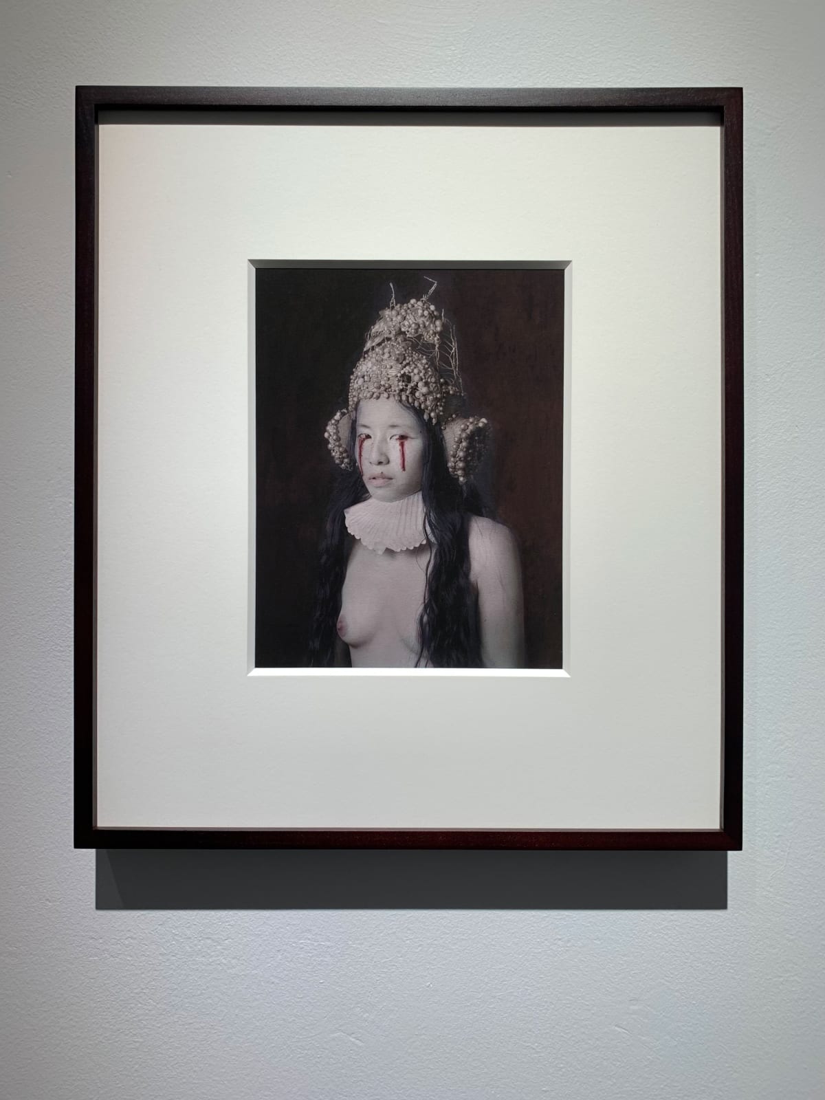 Katie Eleanor, IV., Eye Infection As A Result Of Ingesting Poison, 2015, 2015