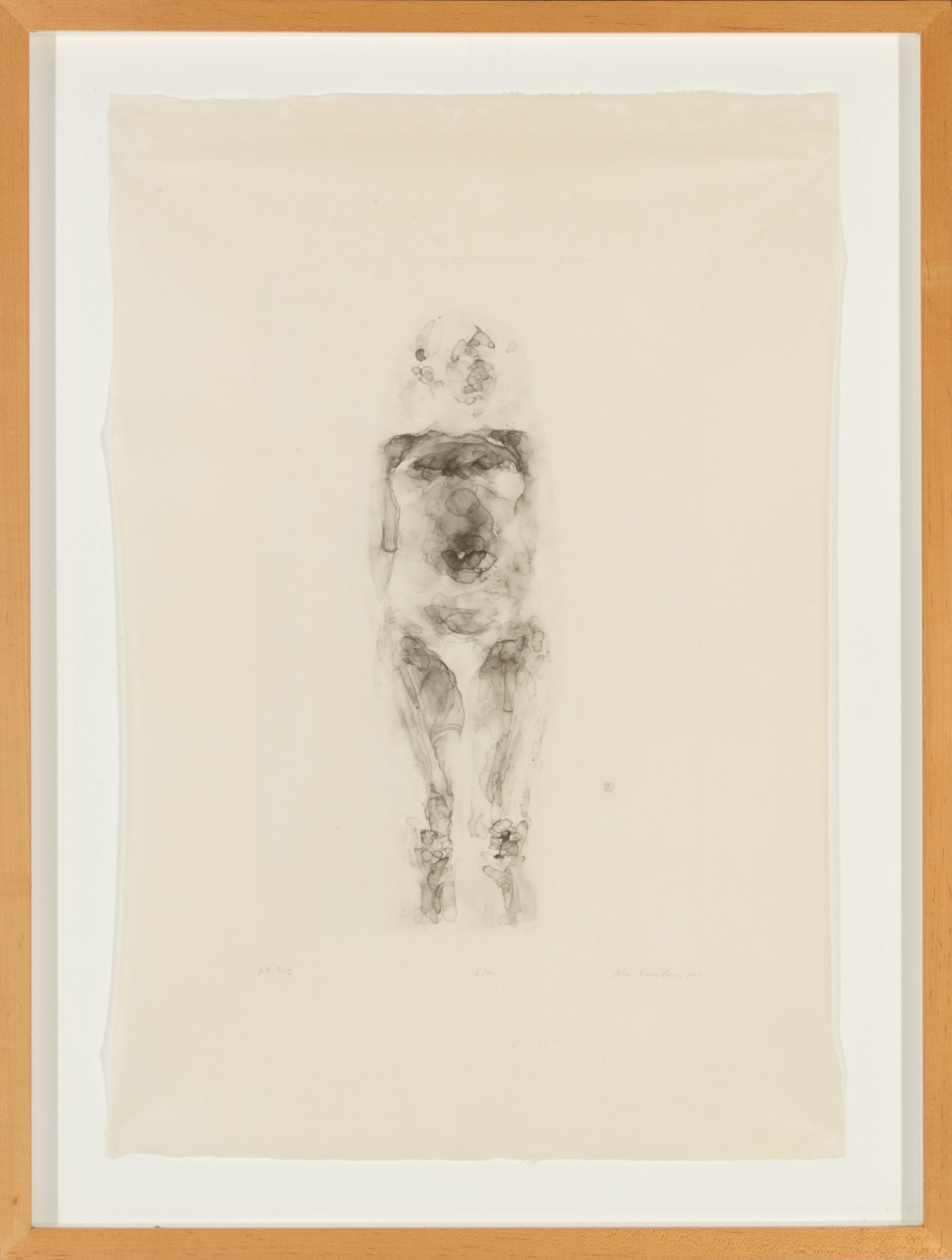 Alex Kanevsky, J.W. (X-Ray Series), 2007 | Hollis Taggart