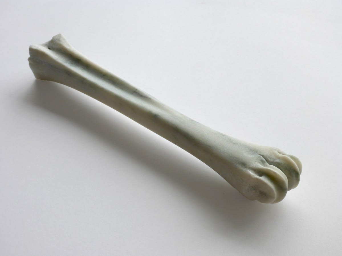 Stephen Shaheen Bone (Tibia), 2015
