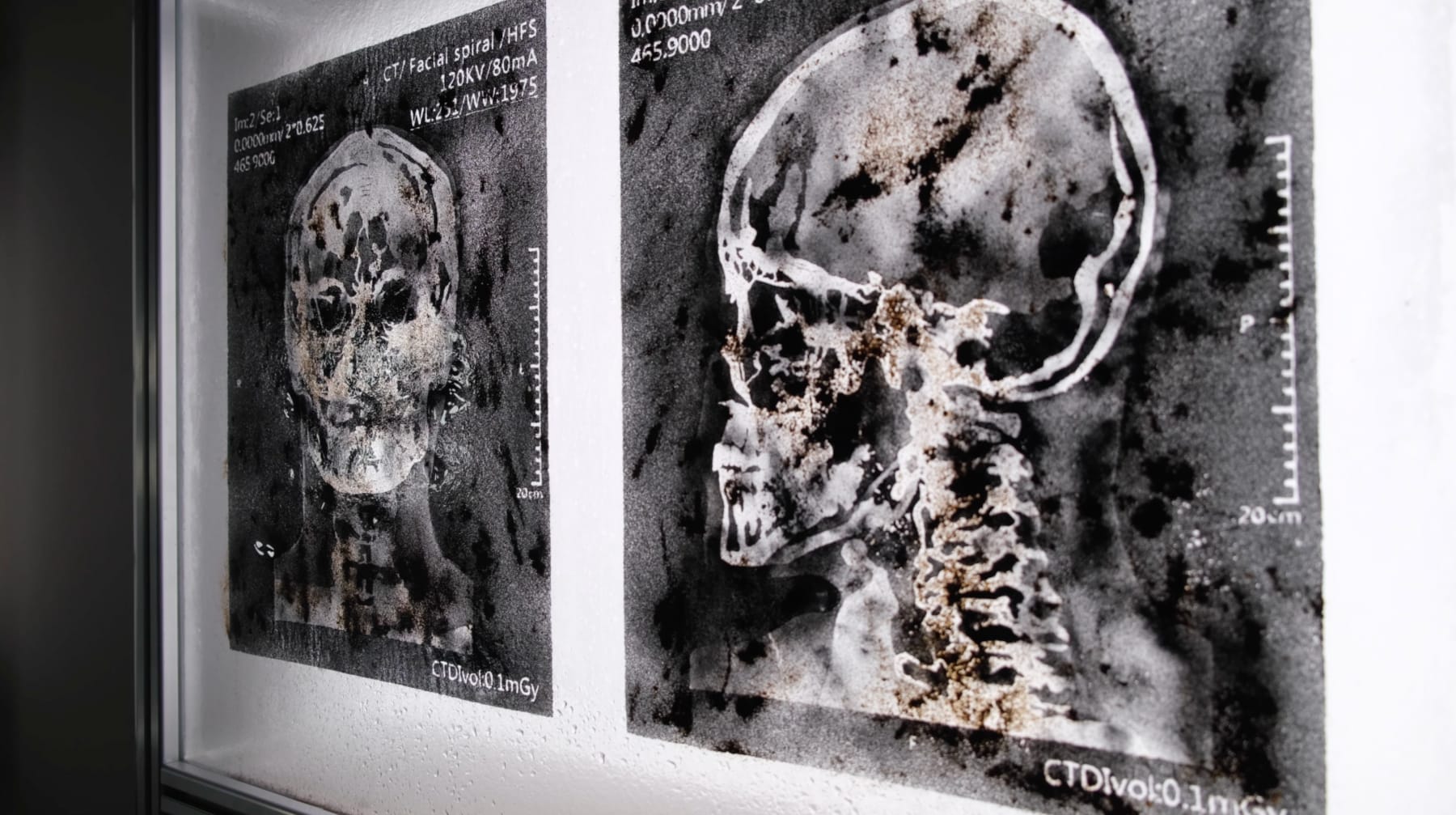 LIANG Zongyao, The Theorized Pain, 2024