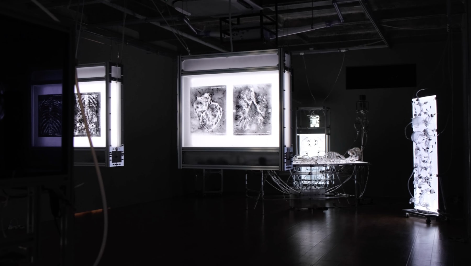 LIANG Zongyao, The Theorized Pain, 2024