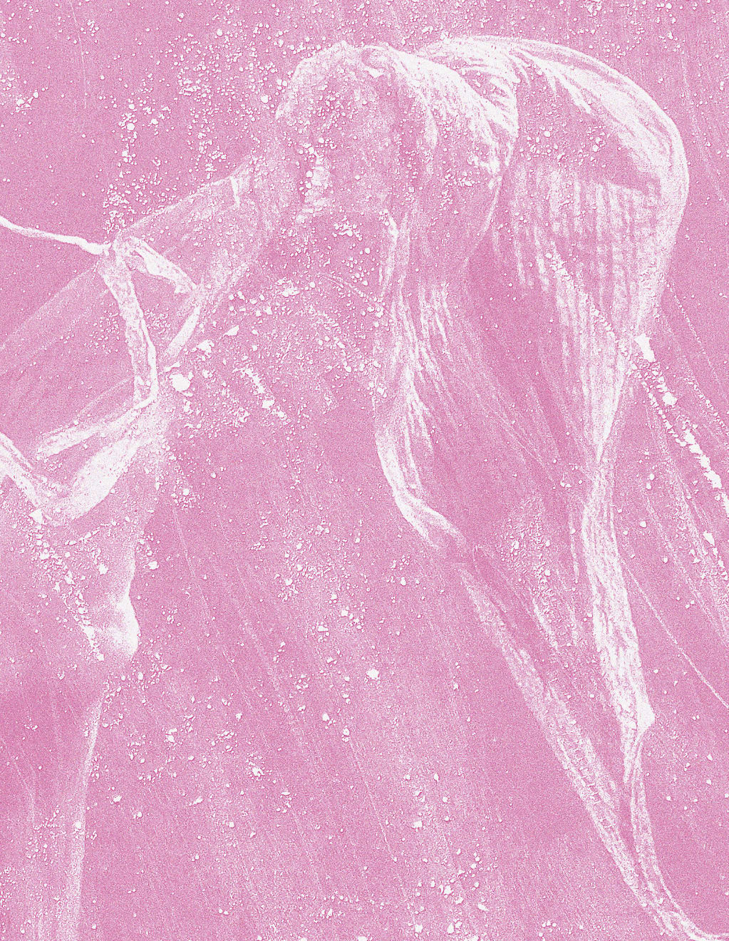 Mauren Brodbeck, Fragment, 2021