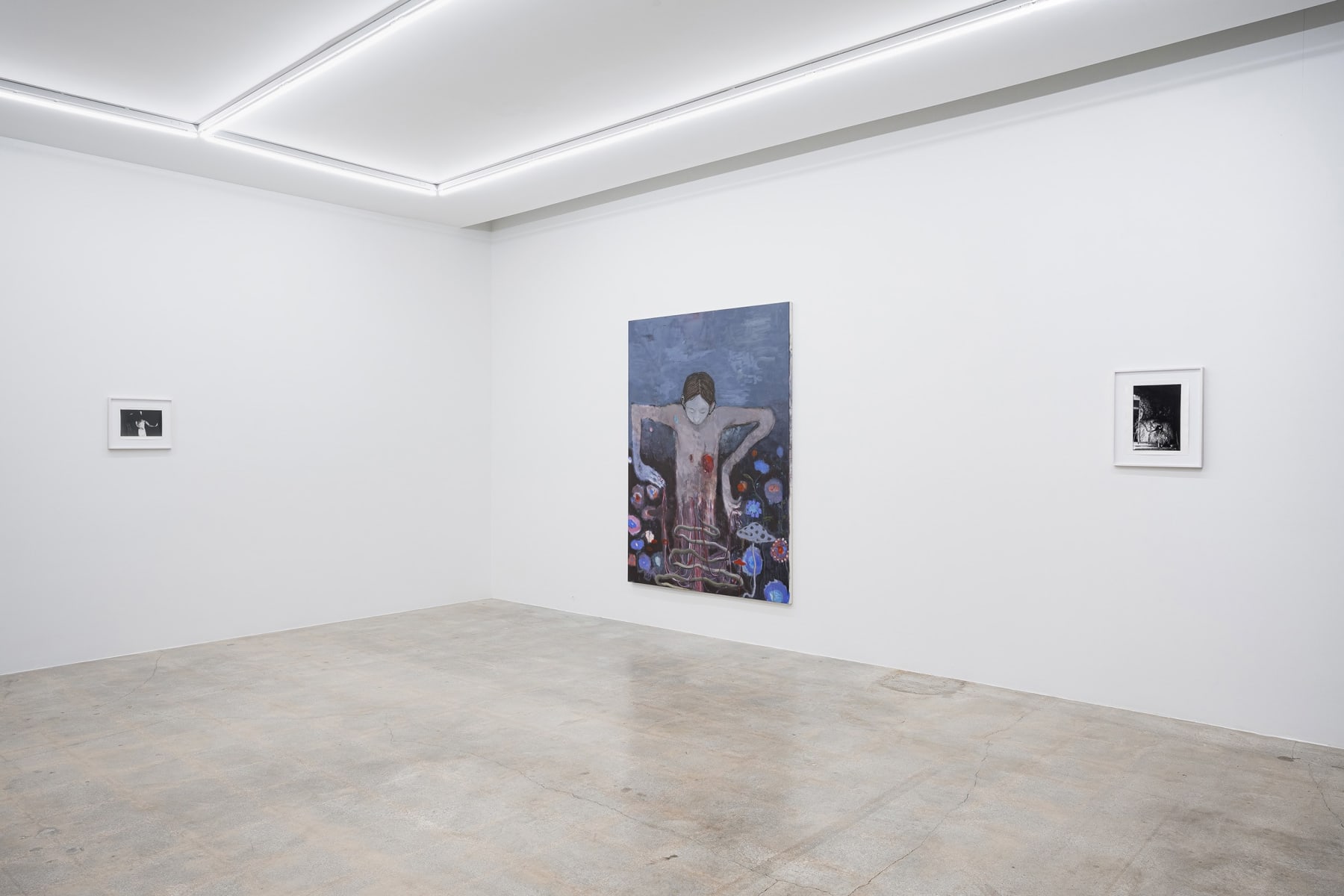 Sanya Kantarovsky, Bleeding Nature, 2023
