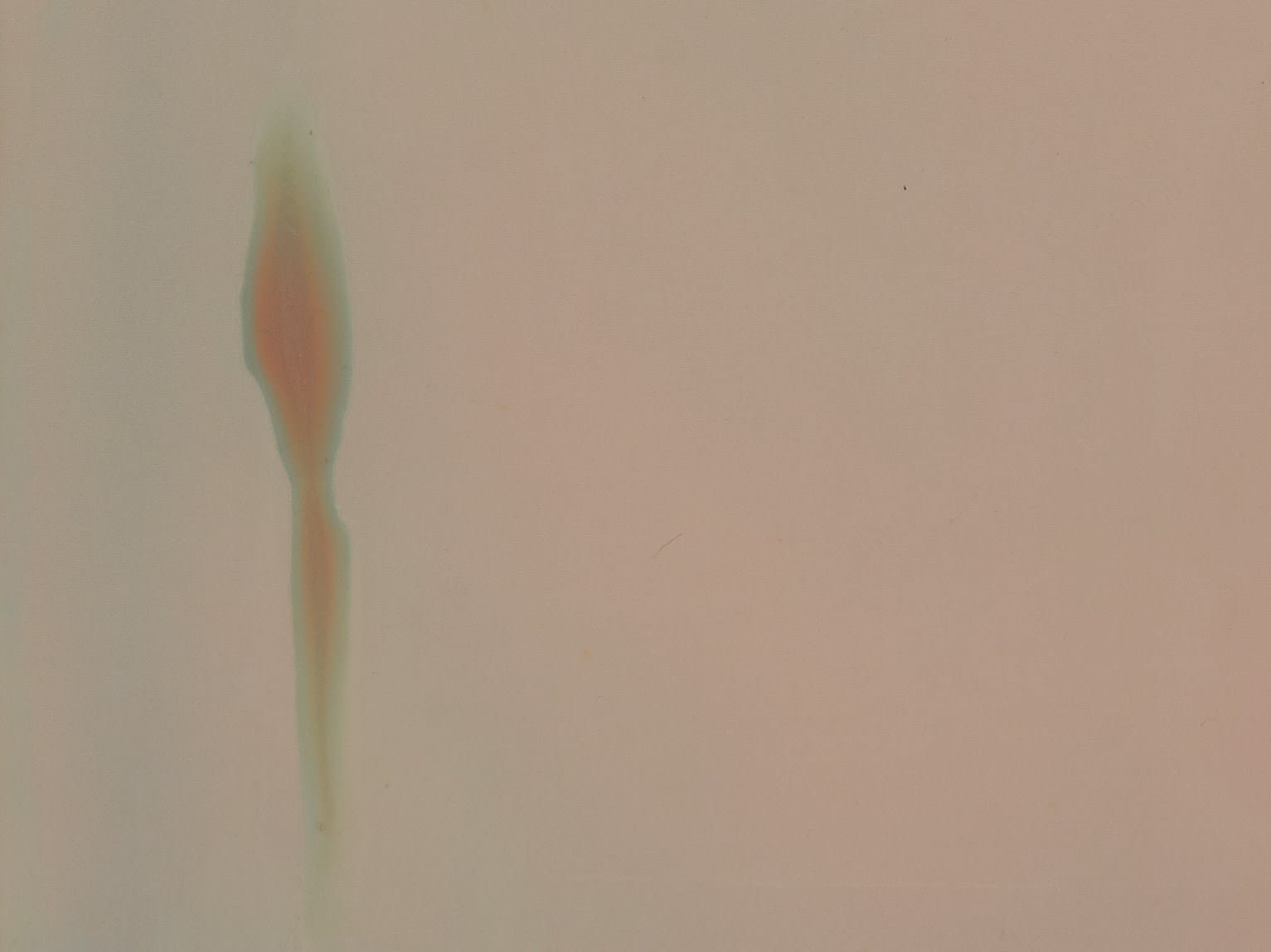 Guo-Liang Tan, Broken Kisses, 2015