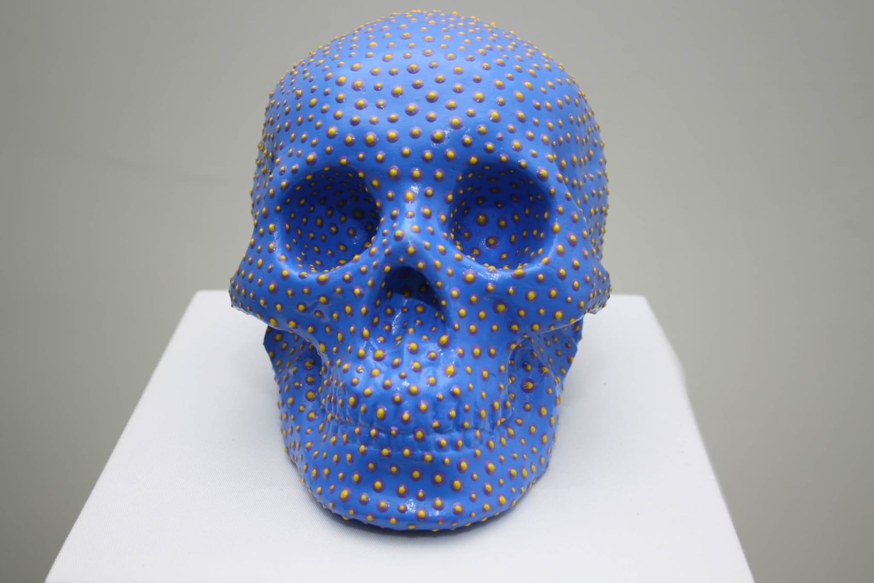 Chen Fei, Because God Loves Me Series, 2008-09