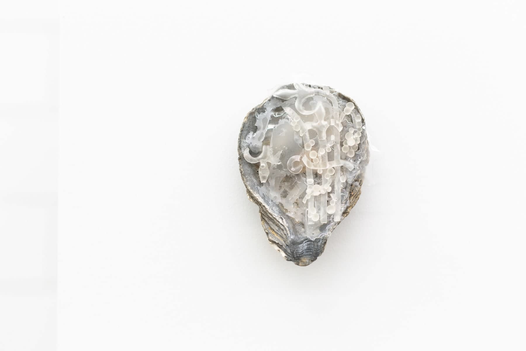 Joshua Petherick, Ear w. Tinnitus, 2015