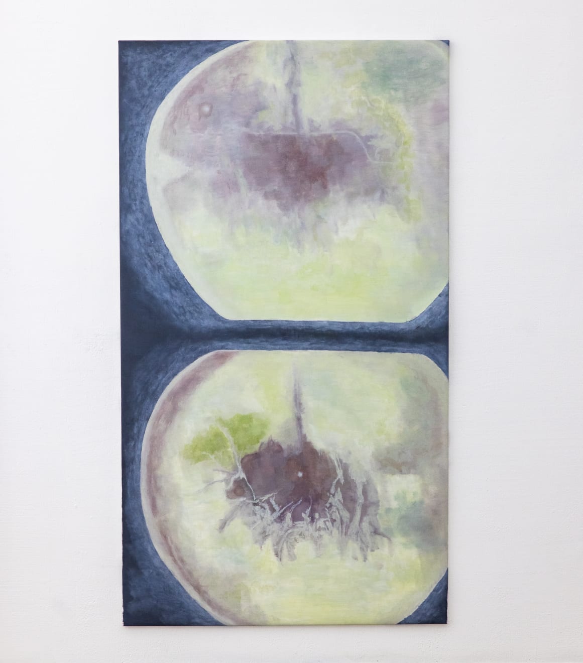 Mantas Platūkis, Akys / Eyes, 2025
