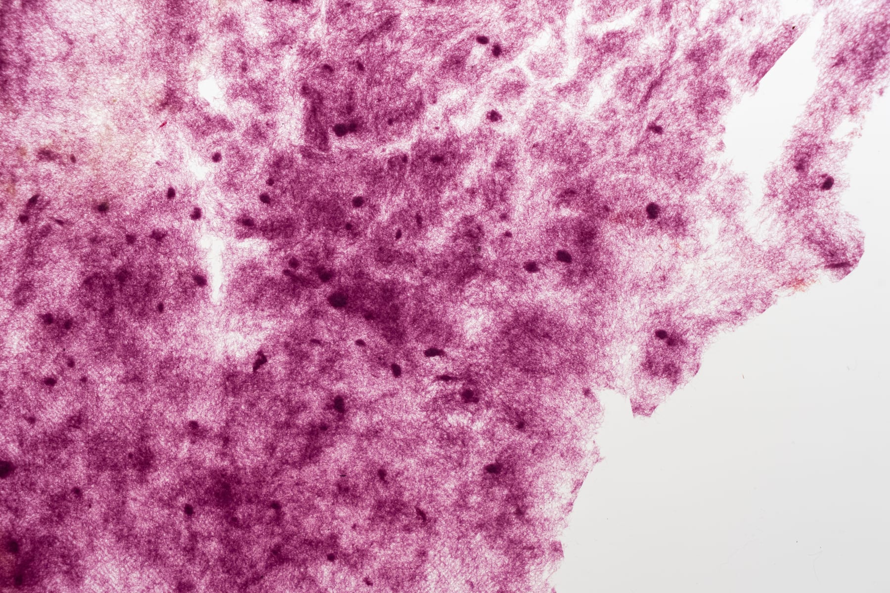 Amelia Toledo, Wisp, undated