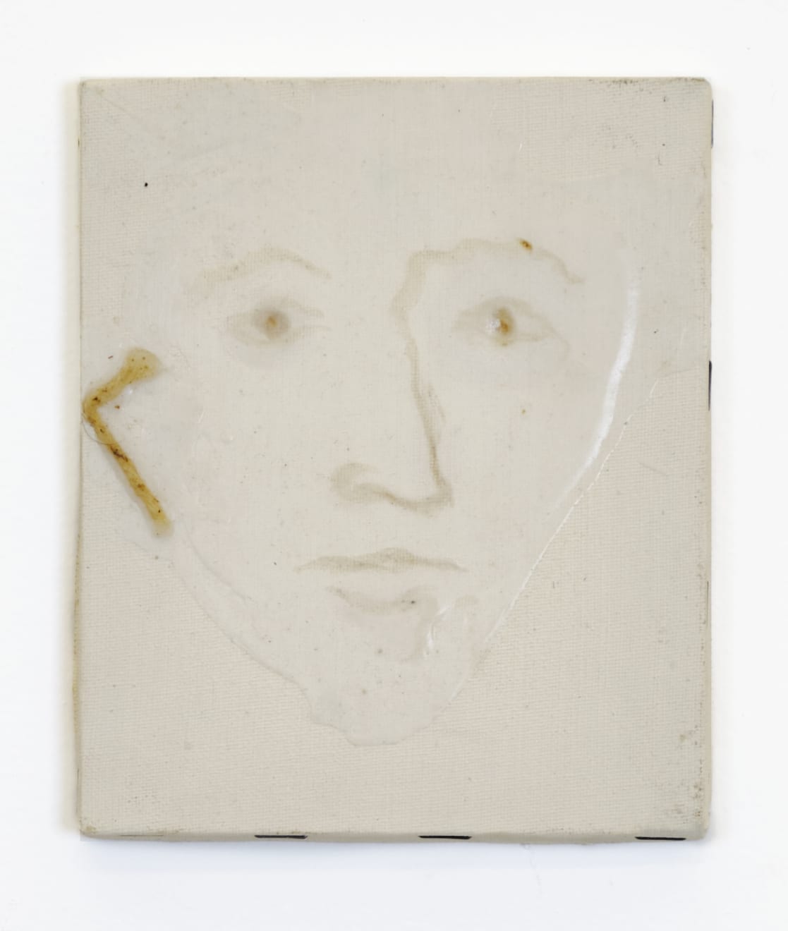 Fernando Zarif, Operação Plástica / Chirurgie Esthétique (Portrait), 1997